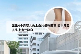 出生4个月婴儿头上白片是咋回事 四个月婴儿头上有一块白