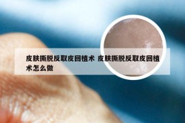 皮肤撕脱反取皮回植术 皮肤撕脱反取皮回植术怎么做