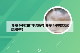 葡萄籽可以治疗牛皮癣吗 葡萄籽可以修复皮肤屏障吗
