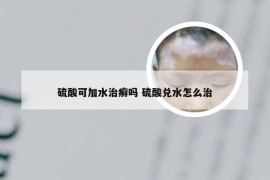 硫酸可加水治癣吗 硫酸兑水怎么治