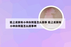 脸上皮肤有小块白斑是怎么回事 脸上皮肤有小块白斑是怎么回事啊