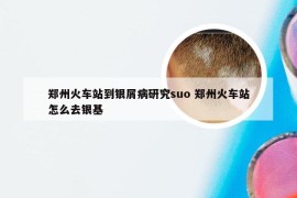 郑州火车站到银屑病研究suo 郑州火车站怎么去银基