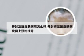 开封友谊皮肤医院怎么样 开封市友谊皮肤医院网上预约挂号