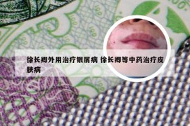徐长卿外用治疗银屑病 徐长卿等中药治疗皮肤病
