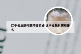 辽宁省皮肤科医院哪家好 辽宁皮肤科医院排名