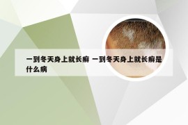 一到冬天身上就长癣 一到冬天身上就长癣是什么病