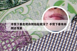 手臂下垂出现白斑抬起就没了 手臂下垂有白斑还发紫