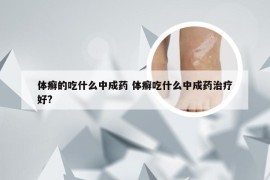 体癣的吃什么中成药 体癣吃什么中成药治疗好?