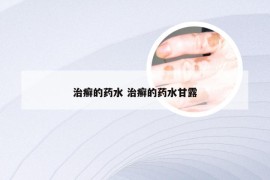治癣的药水 治癣的药水甘露