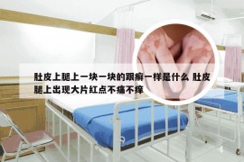 肚皮上腿上一块一块的跟癣一样是什么 肚皮腿上出现大片红点不痛不痒