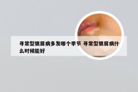 寻常型银屑病多发哪个季节 寻常型银屑病什么时候能好