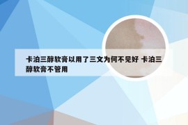 卡泊三醇软膏以用了三文为何不见好 卡泊三醇软膏不管用