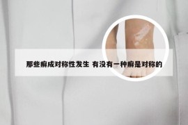 那些癣成对称性发生 有没有一种癣是对称的