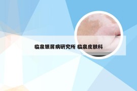 临泉银屑病研究所 临泉皮肤科