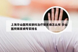 上海华山医院皮肤科治疗银屑病怎么样 华山医院银屑病专家排名