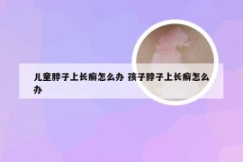 儿童脖子上长癣怎么办 孩子脖子上长癣怎么办