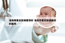 淮南哪里皮肤病看得好 淮南市看皮肤病最好的医院