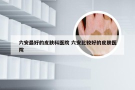 六安最好的皮肤科医院 六安比较好的皮肤医院