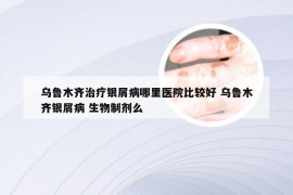 乌鲁木齐治疗银屑病哪里医院比较好 乌鲁木齐银屑病 生物制剂么