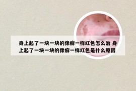 身上起了一块一块的像癣一样红色怎么治 身上起了一块一块的像癣一样红色是什么原因