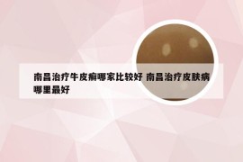 南昌治疗牛皮癣哪家比较好 南昌治疗皮肤病哪里最好