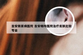 吉安银屑病医院 吉安哪所医院治疗皮肤比较专业