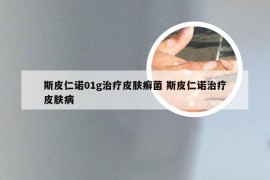 斯皮仁诺01g治疗皮肤癣菌 斯皮仁诺治疗皮肤病