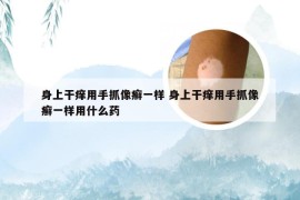 身上干痒用手抓像癣一样 身上干痒用手抓像癣一样用什么药