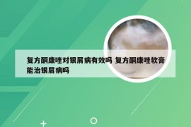 复方酮康唑对银屑病有效吗 复方酮康唑软膏能治银屑病吗