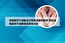 湘雅医院干细胞治疗银屑病最新视频 湖南湘雅医院干细胞银屑病受试者