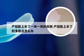 产后脸上长了一块一块的白斑 产后脸上长了好多斑点怎么办