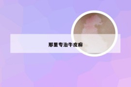 那里专治牛皮癣