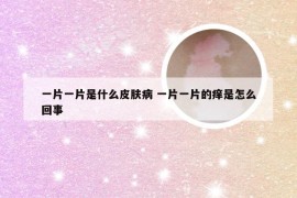 一片一片是什么皮肤病 一片一片的痒是怎么回事
