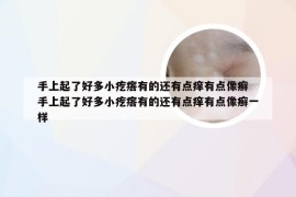 手上起了好多小疙瘩有的还有点痒有点像癣 手上起了好多小疙瘩有的还有点痒有点像癣一样