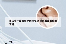 重庆看牛皮癣哪个医院专业 重庆看皮肤癣的专科
