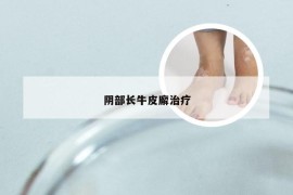 阴部长牛皮廨治疗