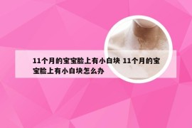 11个月的宝宝脸上有小白块 11个月的宝宝脸上有小白块怎么办