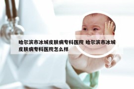 哈尔滨市冰城皮肤病专科医院 哈尔滨市冰城皮肤病专科医院怎么样
