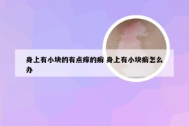 身上有小块的有点痒的癣 身上有小块癣怎么办