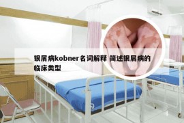 银屑病kobner名词解释 简述银屑病的临床类型