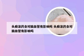 头癣涂药会对脑血管有影响吗 头癣涂药会对脑血管有影响吗