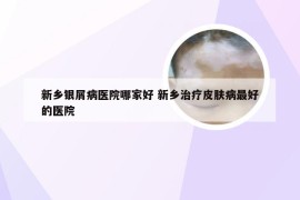 新乡银屑病医院哪家好 新乡治疗皮肤病最好的医院