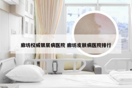 廊坊权威银屑病医院 廊坊皮肤病医院排行