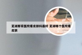 芜湖那家医院看皮肤科最好 芜湖哪个医院看皮肤