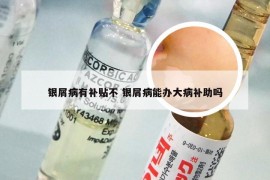 银屑病有补贴不 银屑病能办大病补助吗