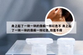 身上起了一块一块的像癣一样红色不 身上起了一块一块的像癣一样红色,但是不痒