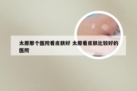 太原那个医院看皮肤好 太原看皮肤比较好的医院