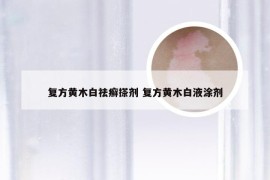 复方黄木白祛癣搽剂 复方黄木白液涂剂