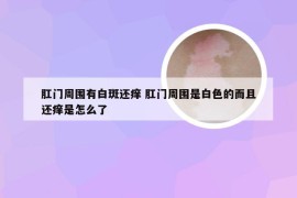 肛门周围有白斑还痒 肛门周围是白色的而且还痒是怎么了