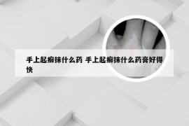 手上起癣抹什么药 手上起癣抹什么药膏好得快